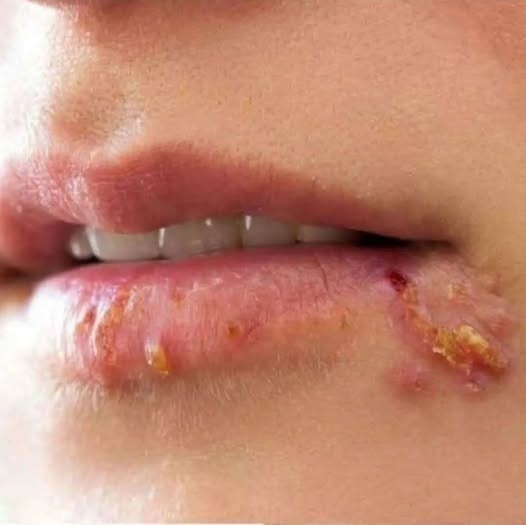 HT4. If you are a WOMAN these are the signs that she is cr… See more