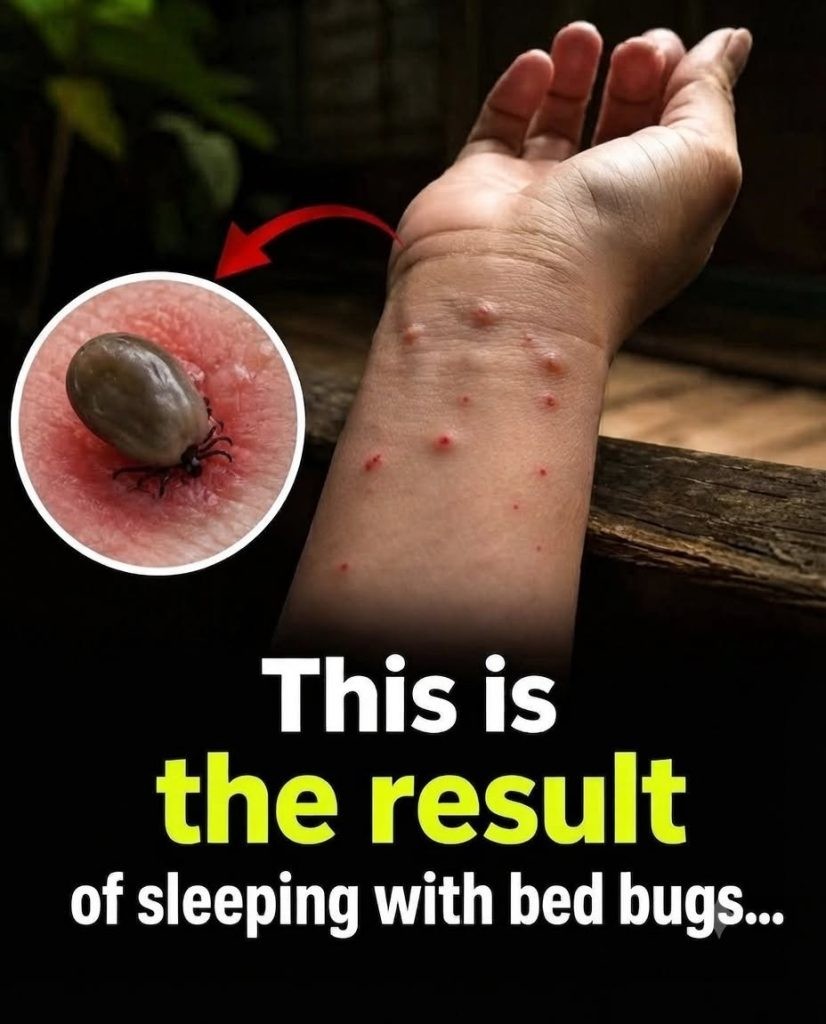 HT1. Bed Bugs Can Hide Where You Least Expect Them
