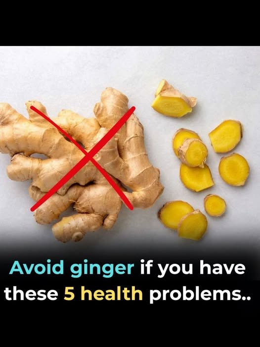 HT1. Avoid Ginger If You Have These 5 Health Problems