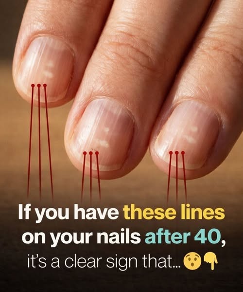 HT1. Foods That Help Strengthen Brittle Nails After 40