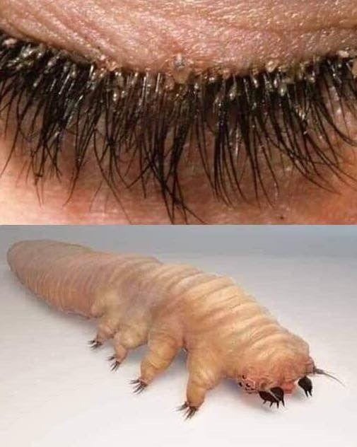 HT3. These are the consequences of sleeping with the… See more