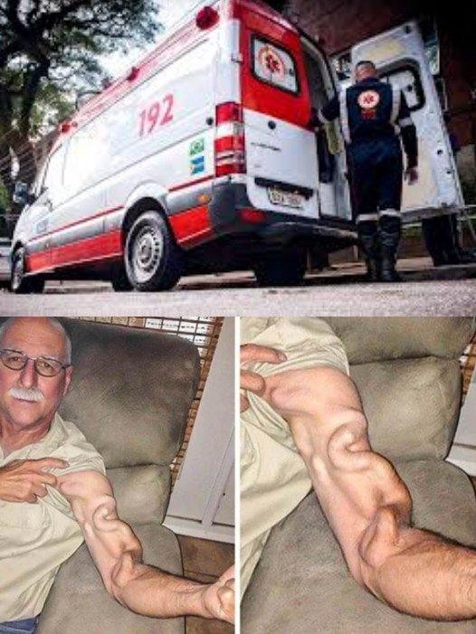 HT2. A man goes to bed and ends up feeling a severe pain in his arm, it was a ca… See more