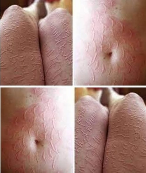 HT4. These are the consequences of sleeping with… See more