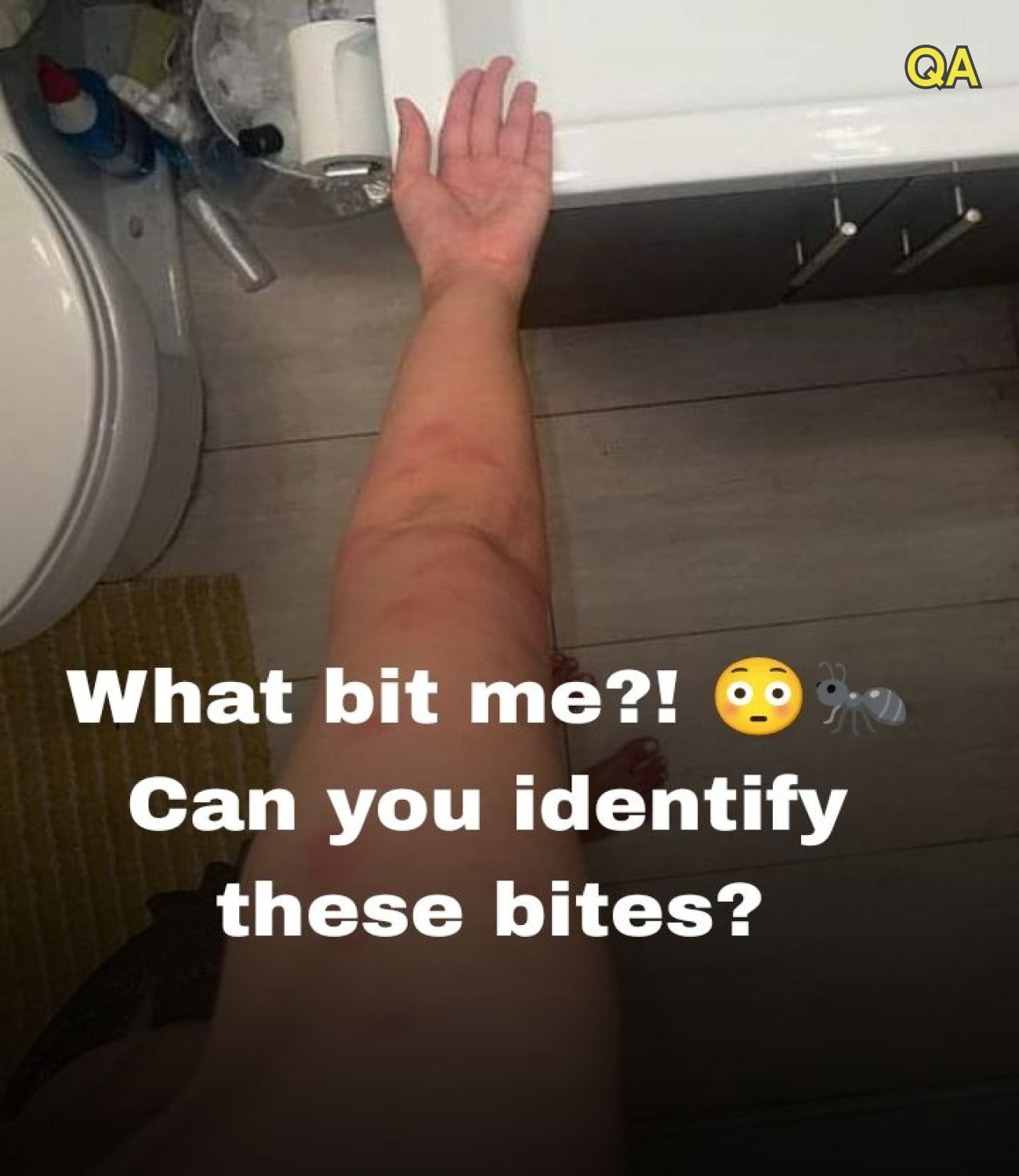 HT1. How to Identify 10 Common Bug Bites and What to Do Next