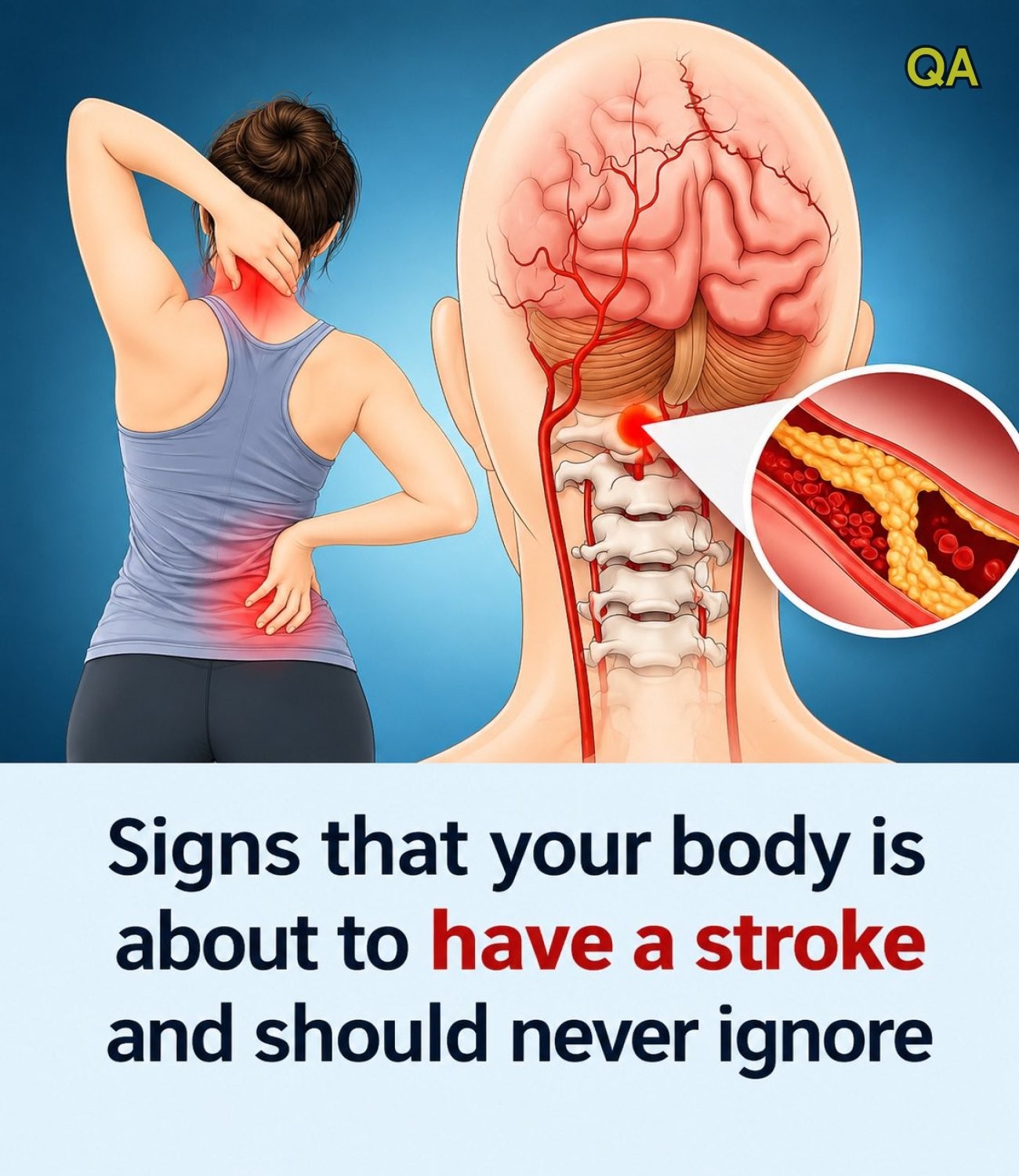 HT4. Warning signs of stroke your body might be sending –