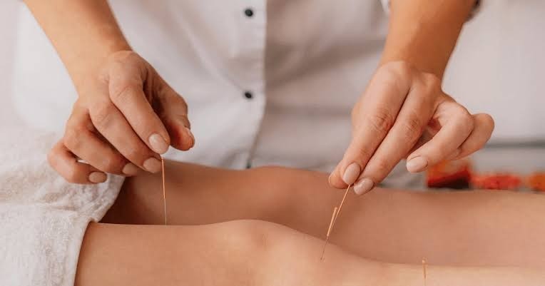 HT3. ‘Gold Mine’ from Acupuncture Inside Woman’s Knees Shocks Doctors