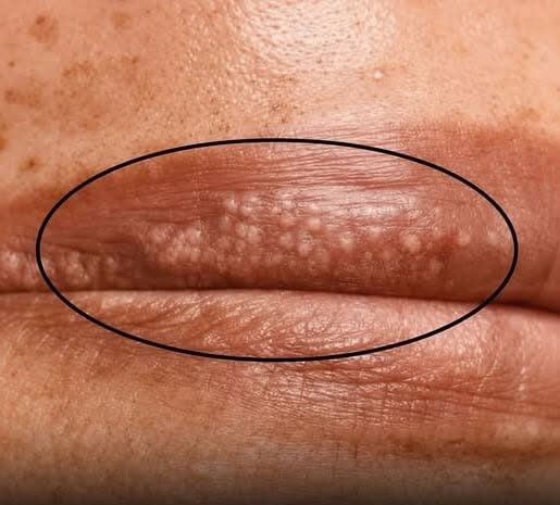 HT2. Those White Spots Might Be Trying To Tell You Something…