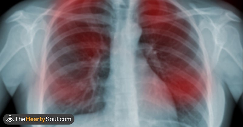 HT1. 20 Early Warning Signs of Cancer and How to Reduce Your Cancer Risk