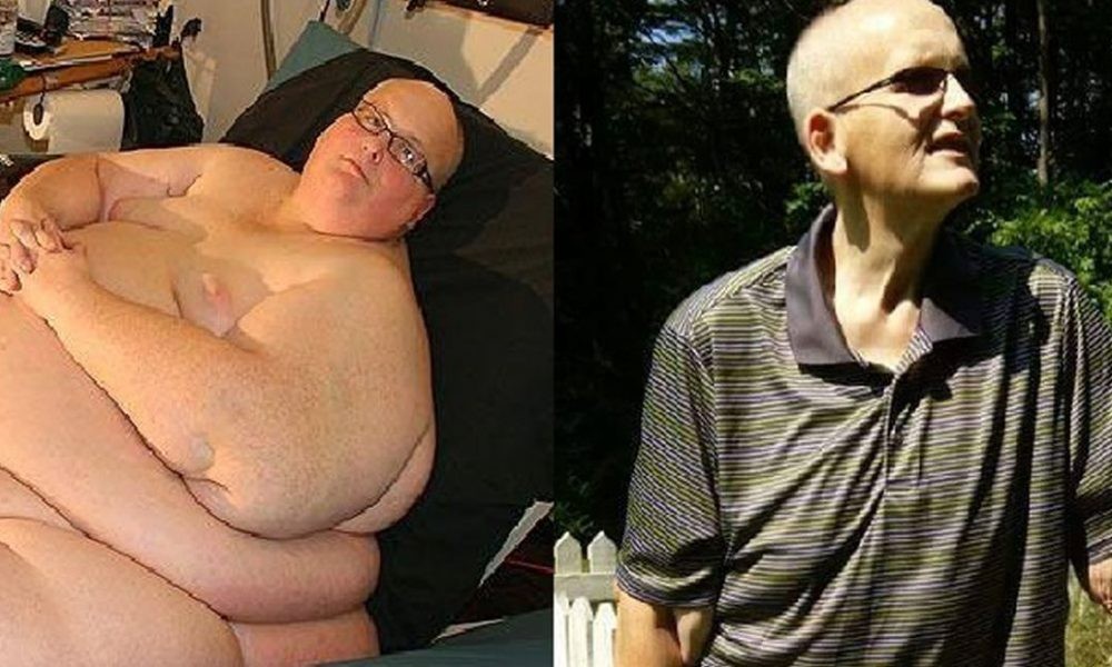 ST1. 10 Of The Biggest Weight Loss Transformations Of All Time