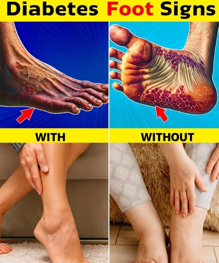 HT1. Boost Your Leg Circulation Naturally with These 6 Simple Exercises