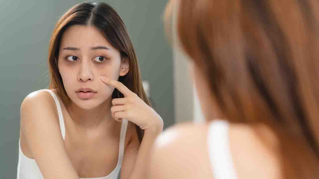 HT4. ‘Ferritin face’ explained as viral trend helps women link mystery symptoms to little-known condition